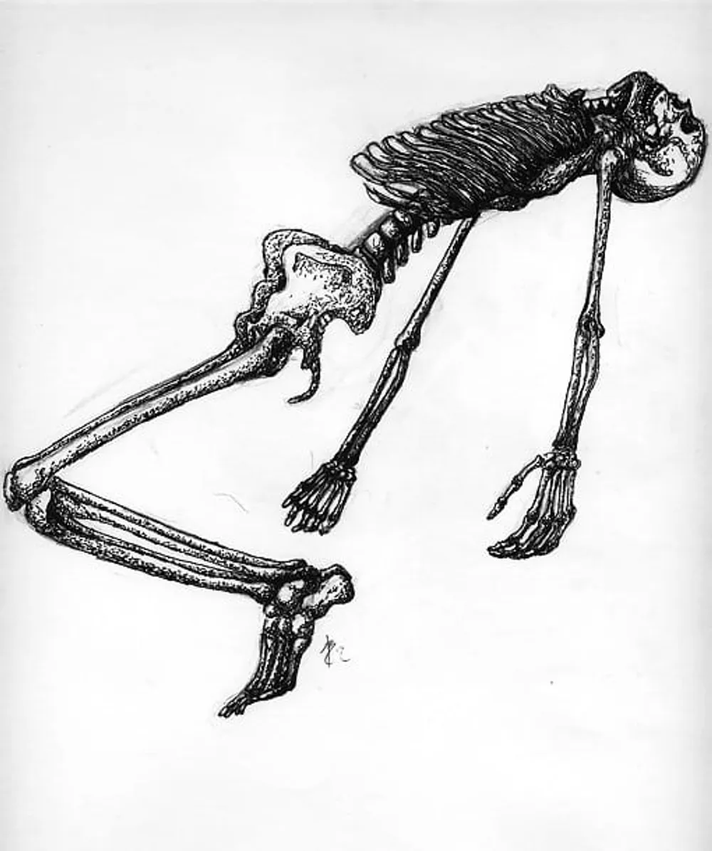 a human skeleton bent into an unnatural pose
